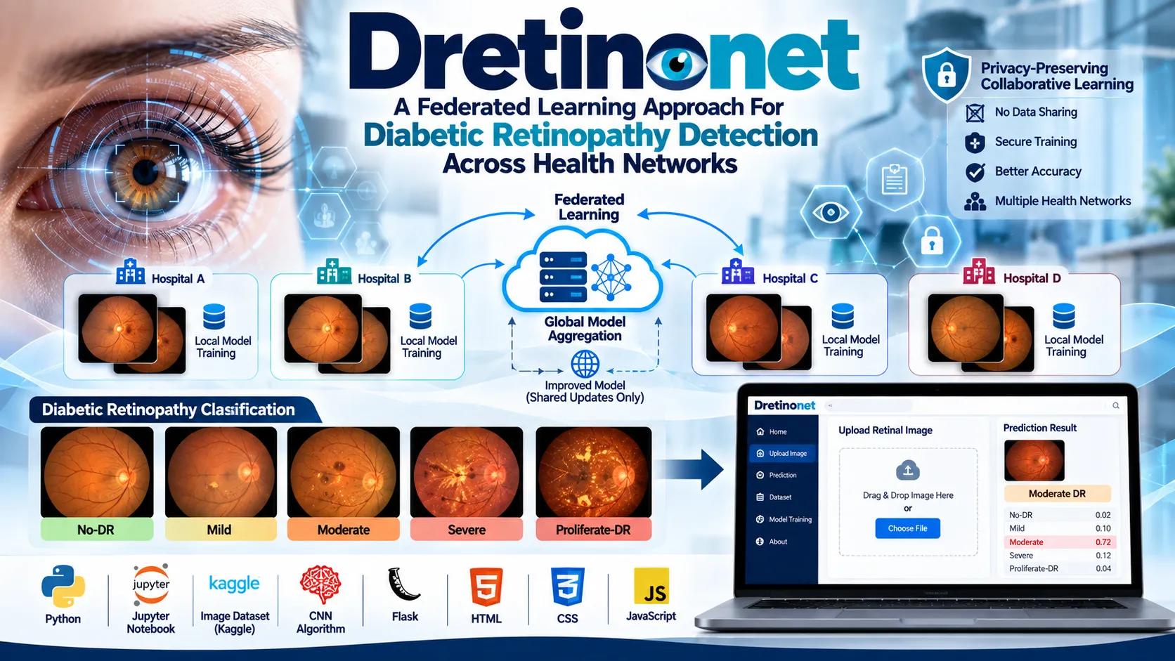 Dretinonet: A Federated Learning Approach For Diabetic Retinopathy Detection Across Health Networks